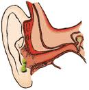 инфекция на ухото